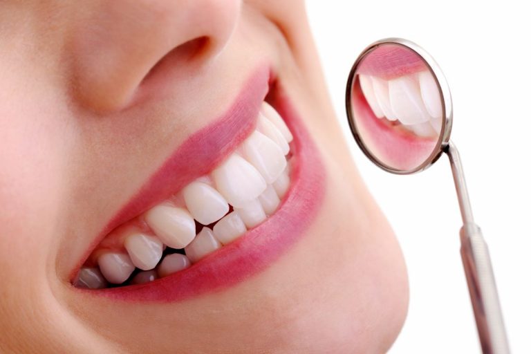 Do-It-Yourself Teeth Brightening: Does It Worth The effort?