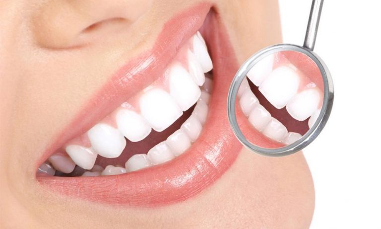 Smile Bright Teeth Whitening Christchurch: Unveiling the Secret to Radiant Smiles